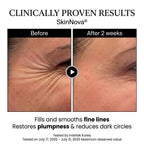 SkiNova® | Silk-Collagen Peptide Serum